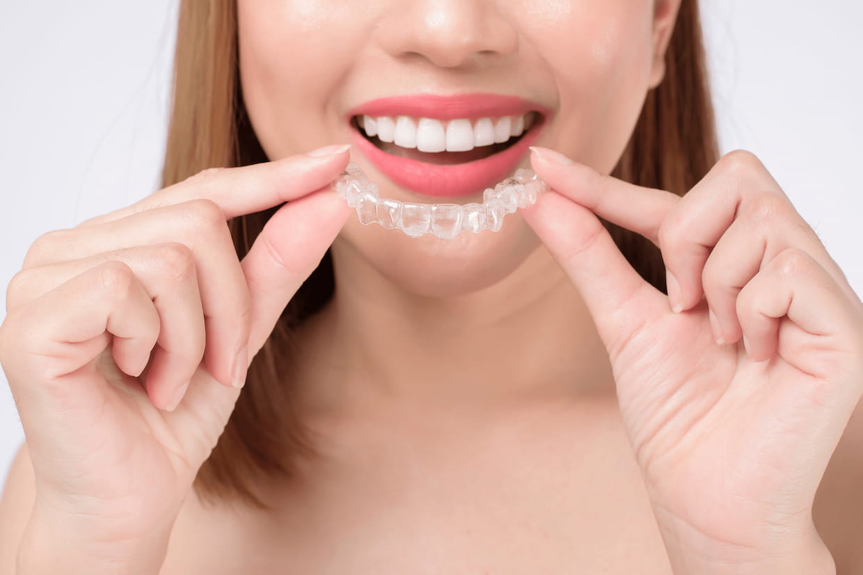 preguntas frecuentes de invisalign