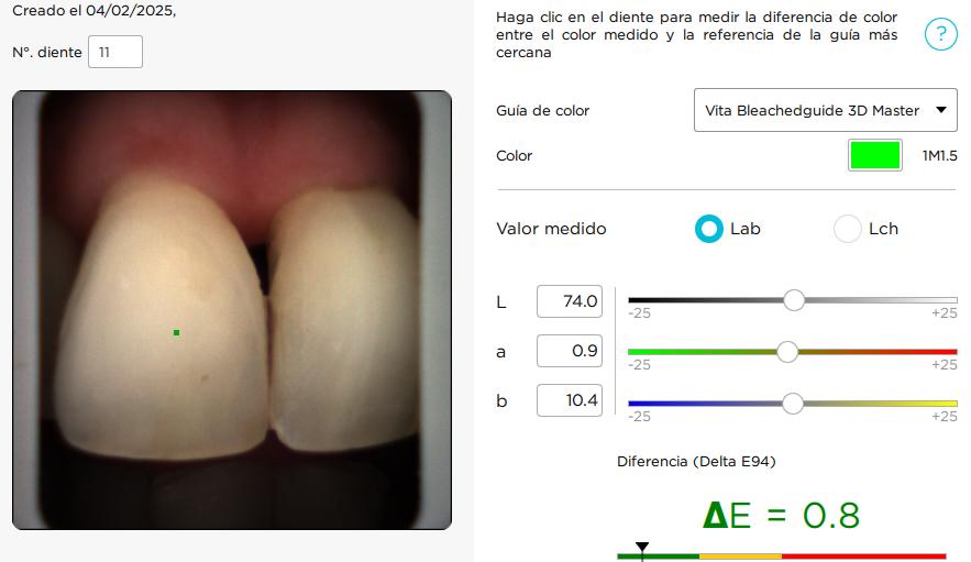 teeth whitenning process